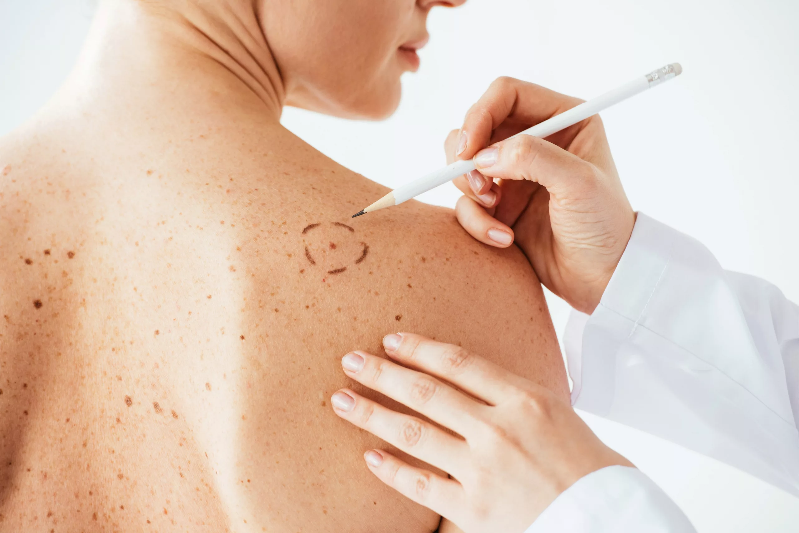 Consultation dermatologie Casablanca