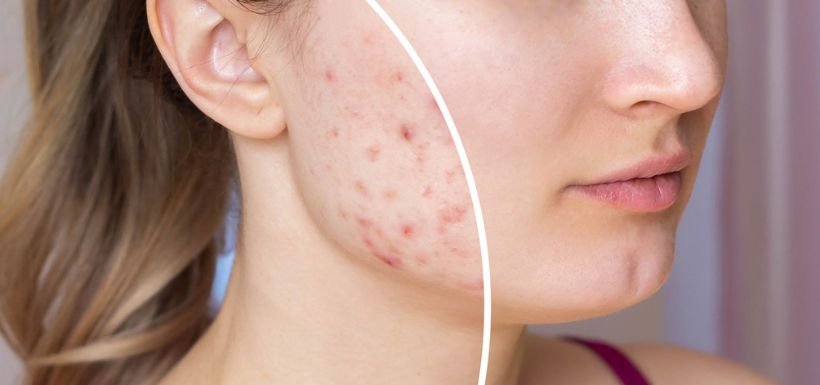 Chirurgie de la peau Casablanca