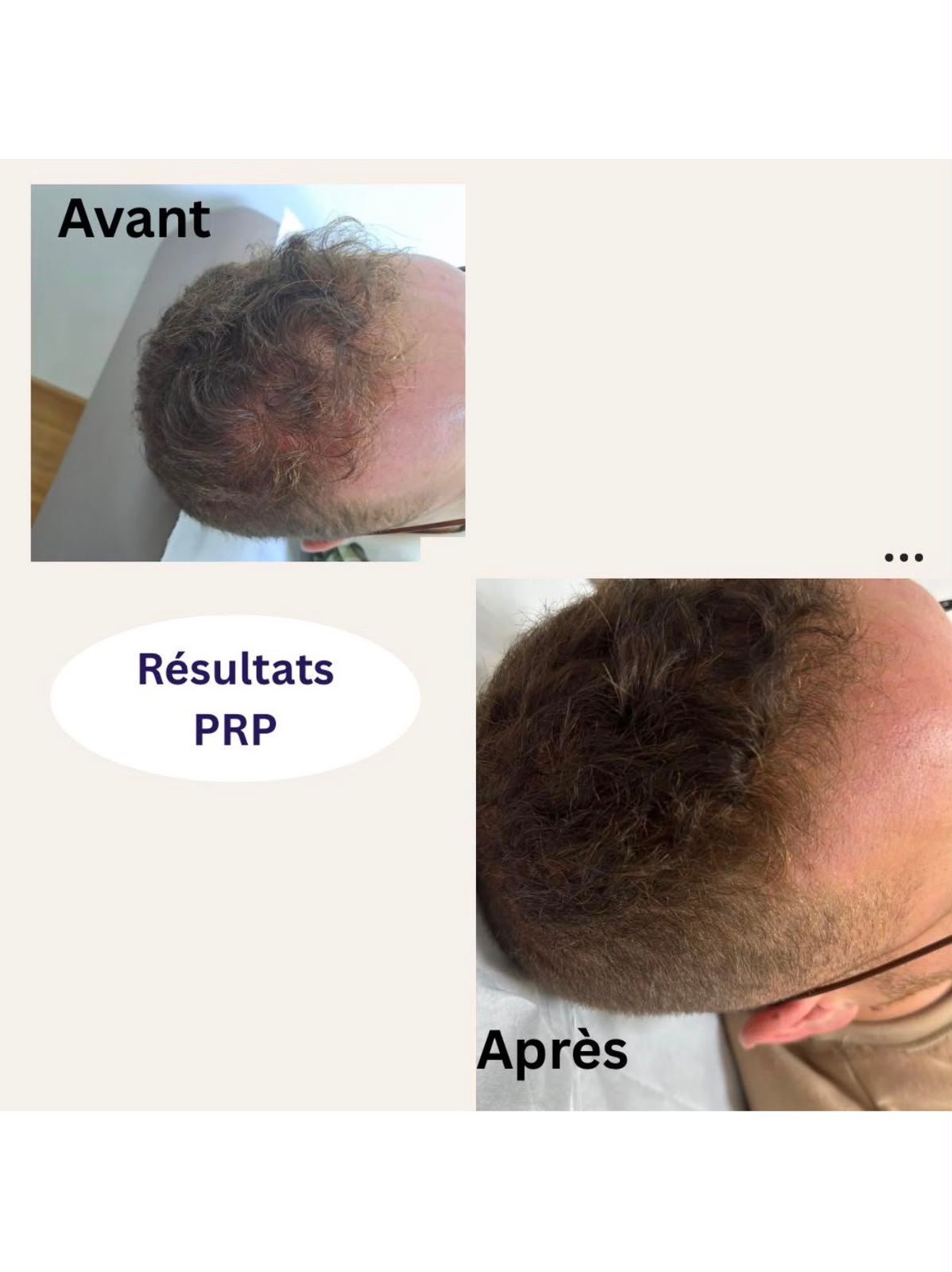Résultat 1